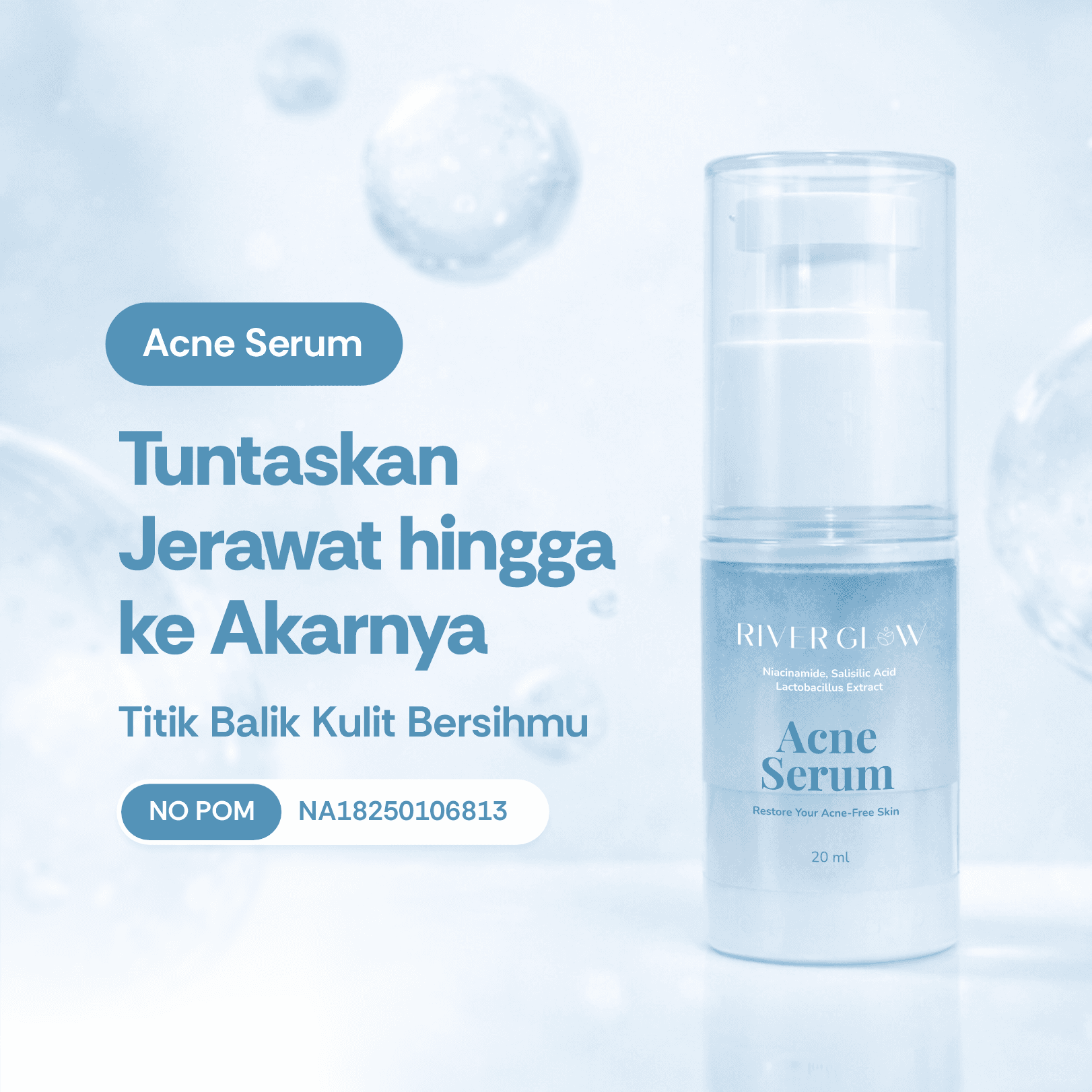 Acne Serum